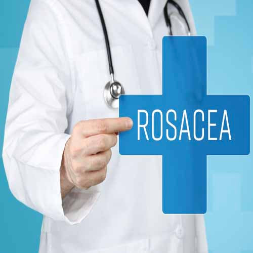 Skin Boutique Online | Understanding Rosacea: A Dermatologist's Guide