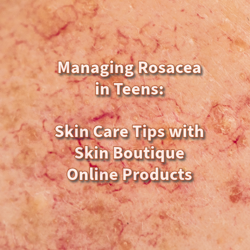 Managing Rosacea in Teens: Expert Strategies for Effective Treatment and Care to Support Adolescents' Skin Health