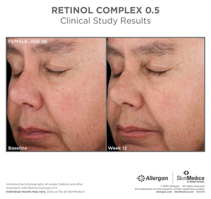 Retinol Complex 1, 0.5 or 0.25 by SkinMedica®