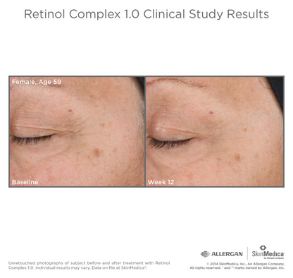 Retinol Complex 1, 0.5 or 0.25 by SkinMedica®