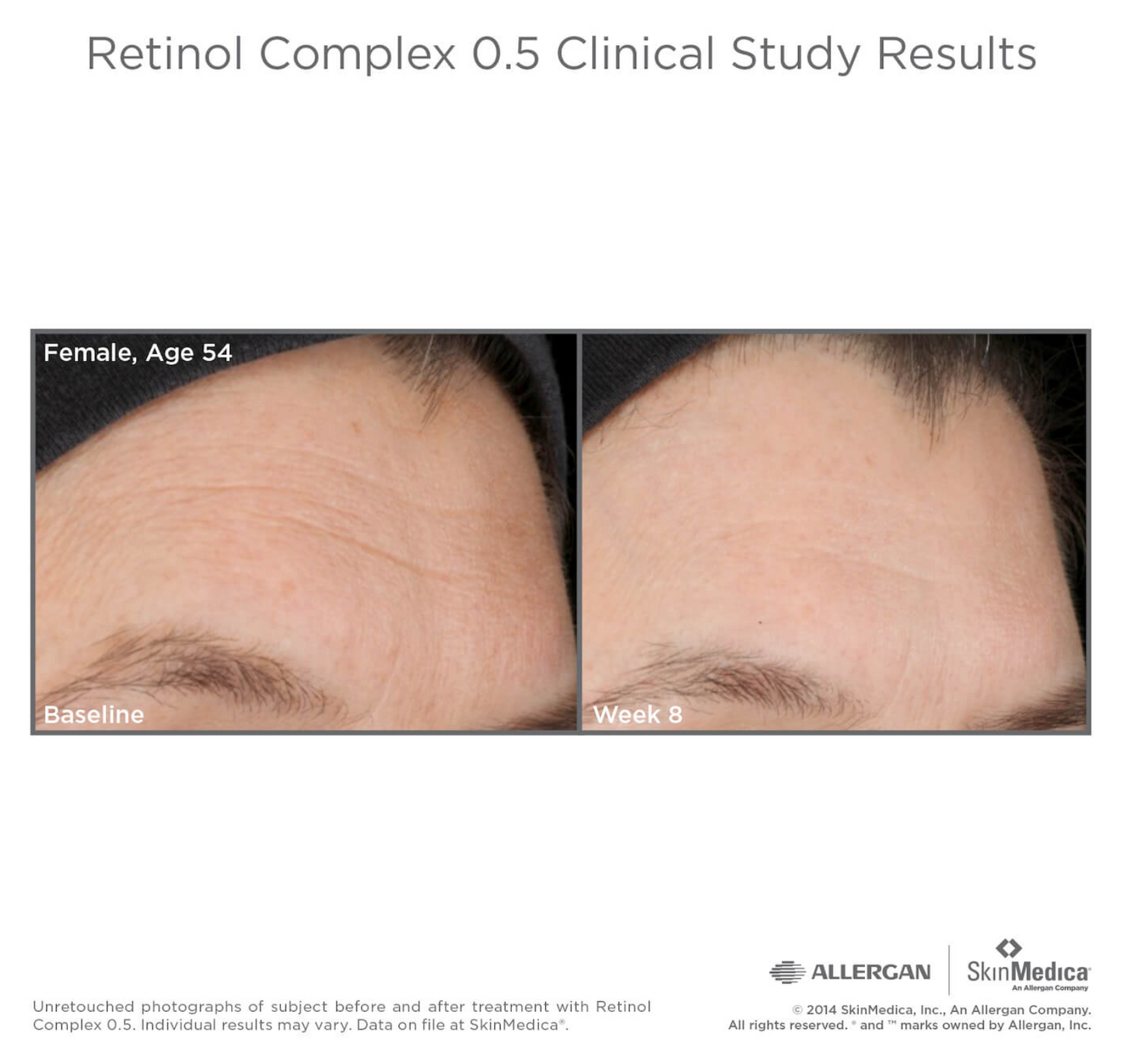 Retinol Complex 1, 0.5 or 0.25 by SkinMedica®